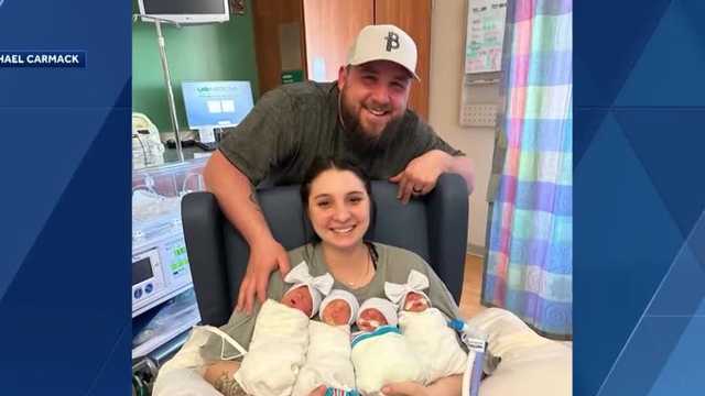 Woman gives birth to two sets of identical twins - Vimarsana News