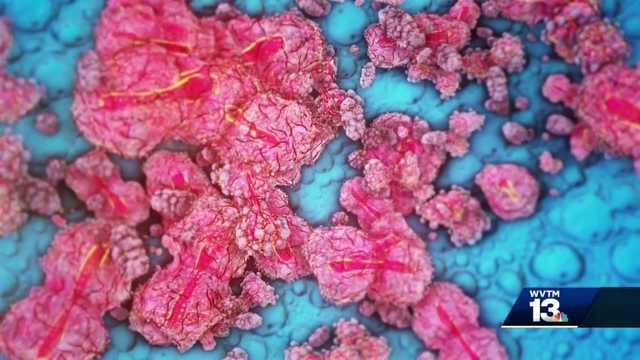 Infectious disease expert explains monkeypox virus, LGBTQ+ stigma - Vimarsana News