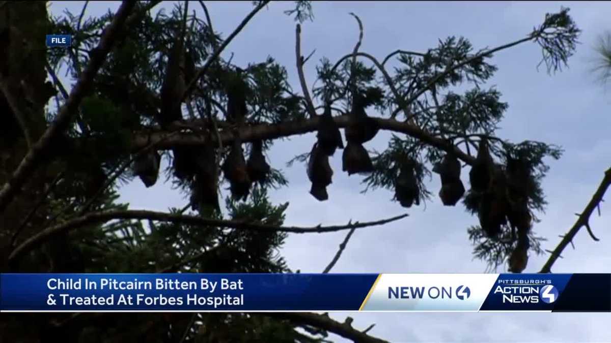 Health Department advising public of rabies risk after child was bit by