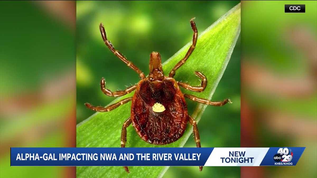 Local Alpha-gal expert speaks to 40/29 News