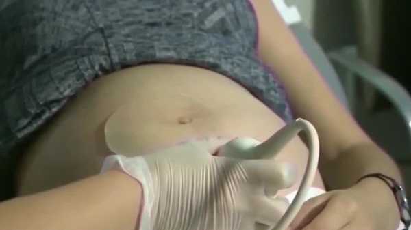 district court orders the 6 week fetal heartbeat abortion ban can take effect monday morning