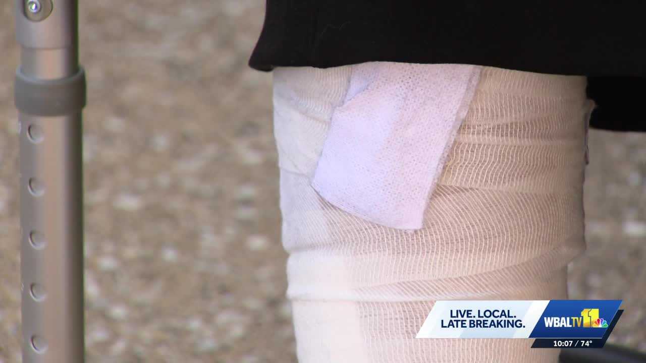 Joppa woman injured in leashless dog attack