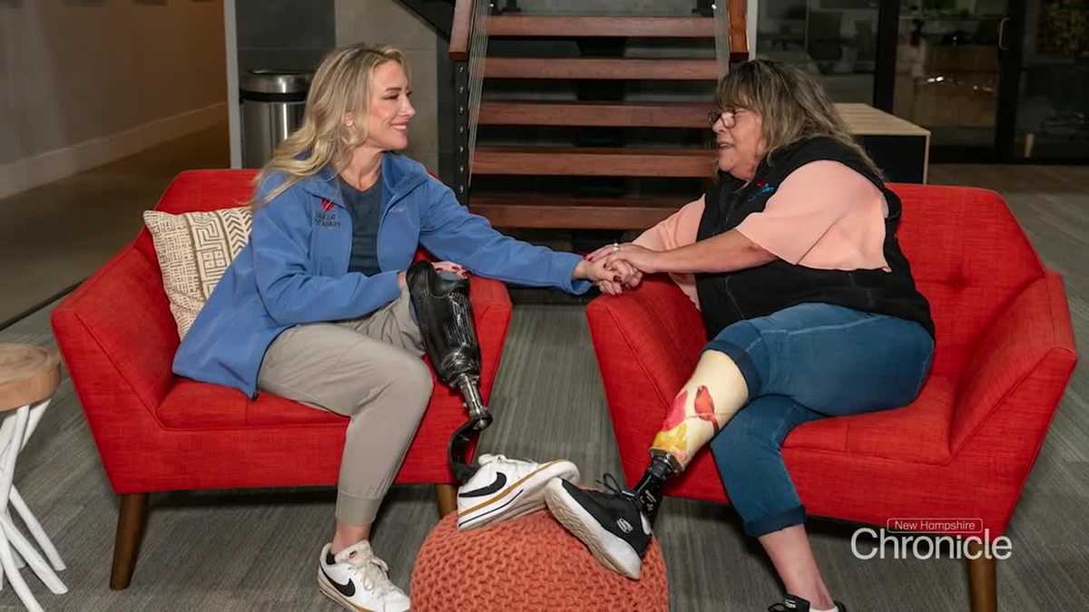 Nashua native turns amputation journey into hope for others