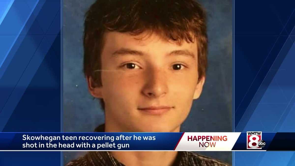 Teen expected to recover after getting shot in the head with a pellet gun