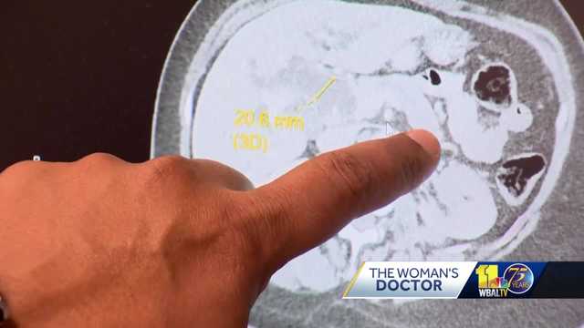 Pancreatic cancer rates up in younger women - Vimarsana News