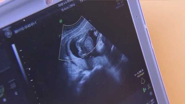 Lawmakers seek exception to NH 24-week abortion ban - Vimarsana News