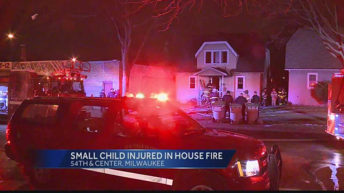 Child injured in Milwaukee house fire