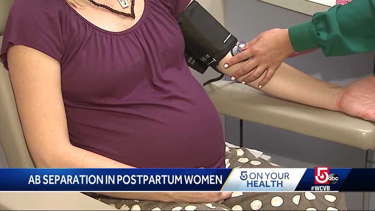 Abs separation is common for postpartum women