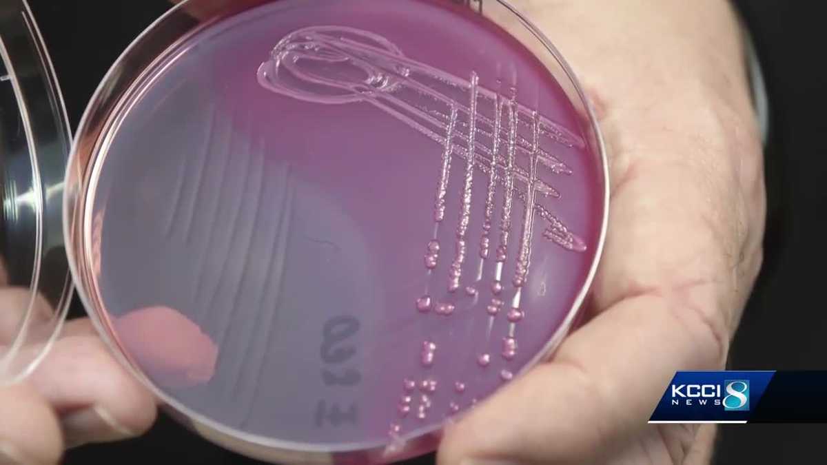 Department of Health shares warning signs of E. coli after child’s death