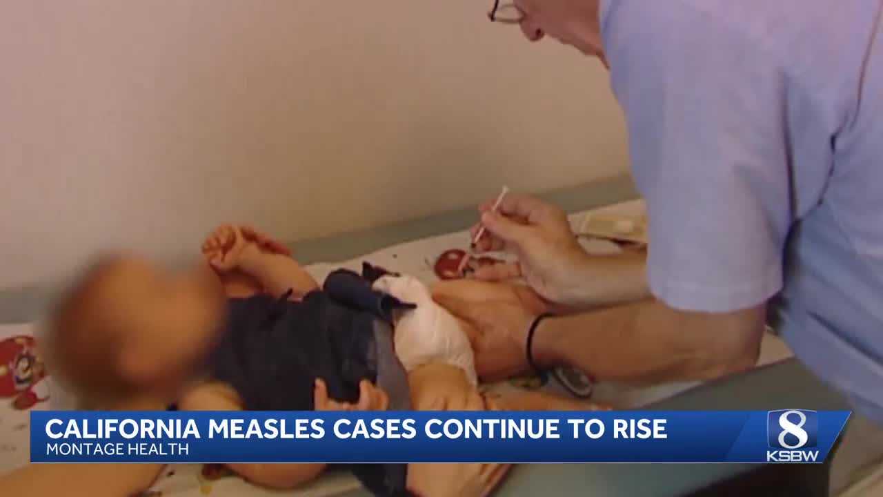 California sees rise in measles cases amid vaccination concerns