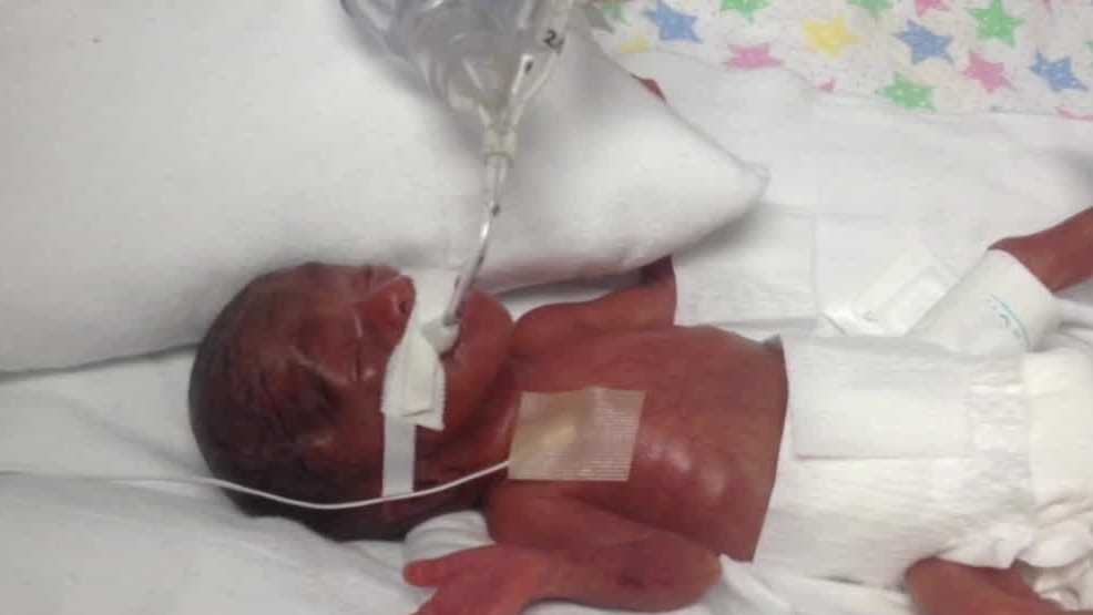 Smallest surviving baby born at Milwaukee hospital reunites with care team 10 years later - Vimarsana News