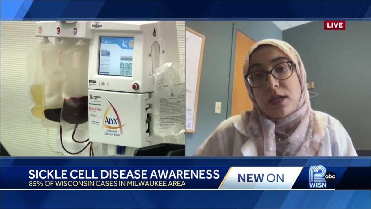 UW Health: Sickle cell disease awareness