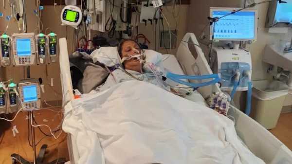 'cpr saved my life': iowa woman's survival underscores new lifesaving guidelines