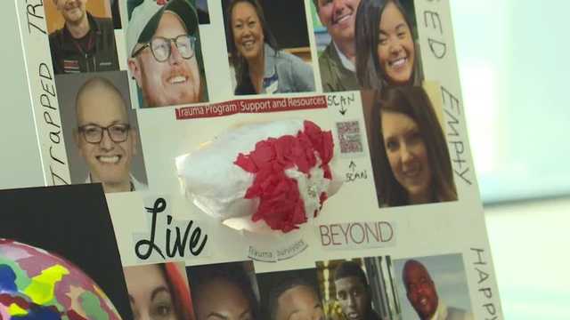 UofL Health celebrating trauma survivors with exhibit at Speed Art Museum - Vimarsana News