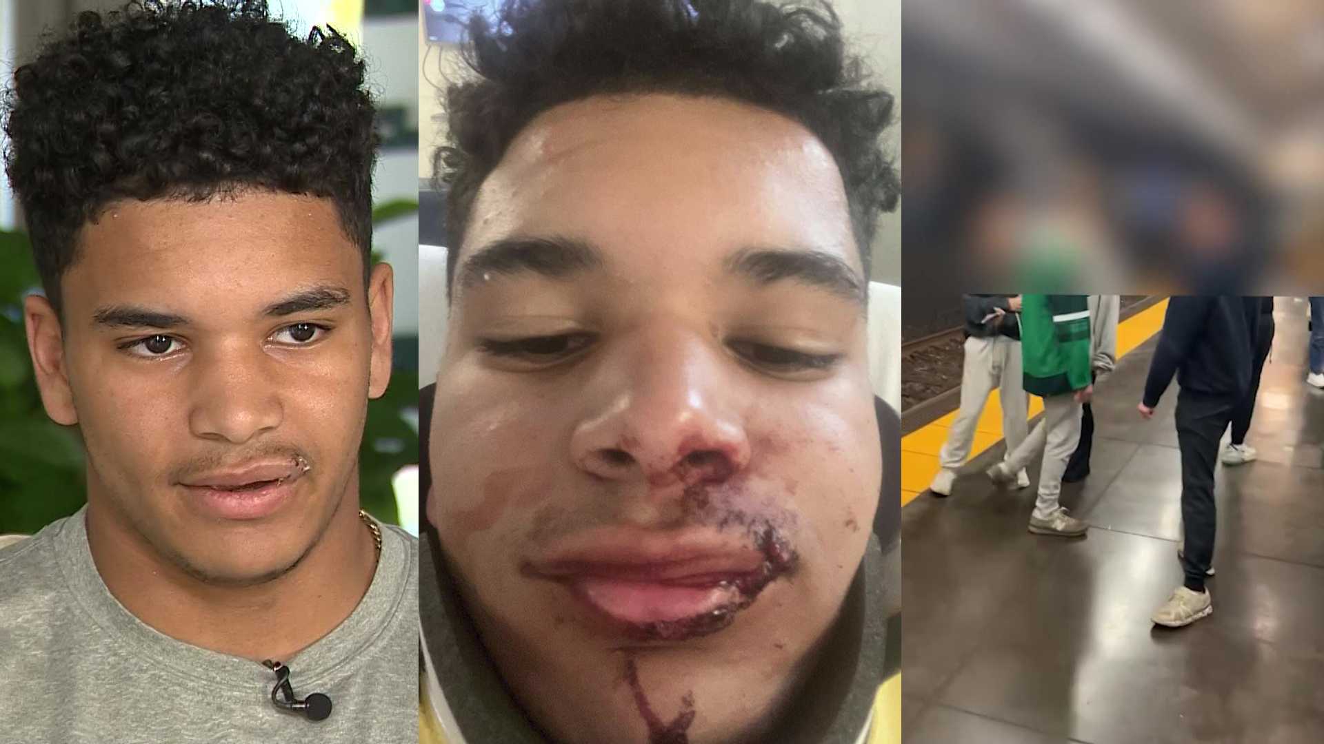 Teen says he was attacked by group inside Kenmore Station after Red Sox game - Vimarsana News
