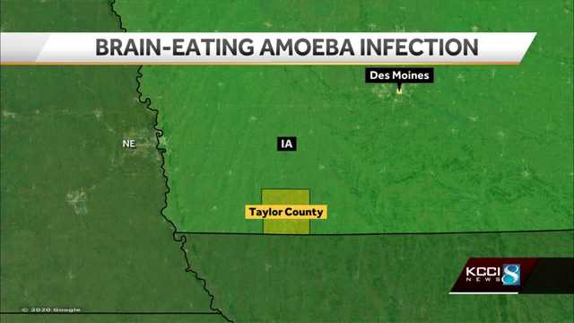 Iowa beach closed as precaution after confirmed infection of Naegleria fowleri - Vimarsana News