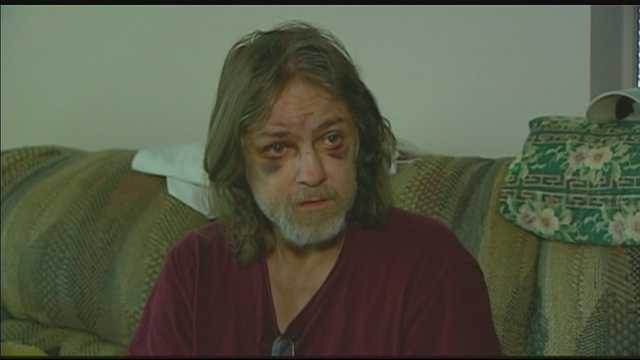 Missouri man forced to play dead to survive brutal assault