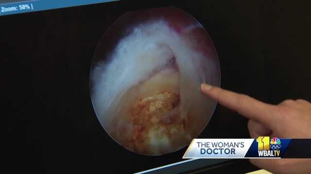 Woman's Doctor: Constant shoulder pain can lead to surgery - Vimarsana News