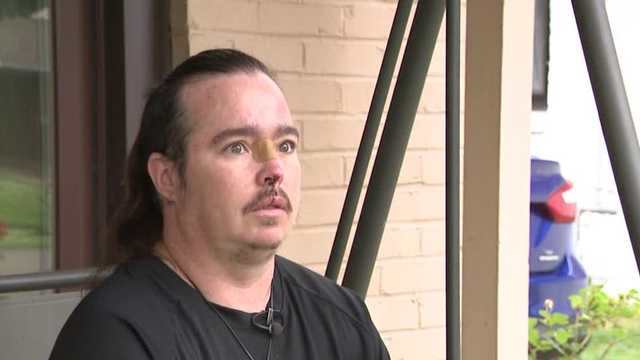 Cyclist recovering after hit-and-run in St. Matthews; police looking for suspect