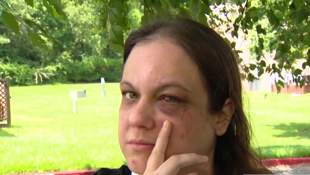 Nurse attacked after honking at car that stopped in middle of Maryland road