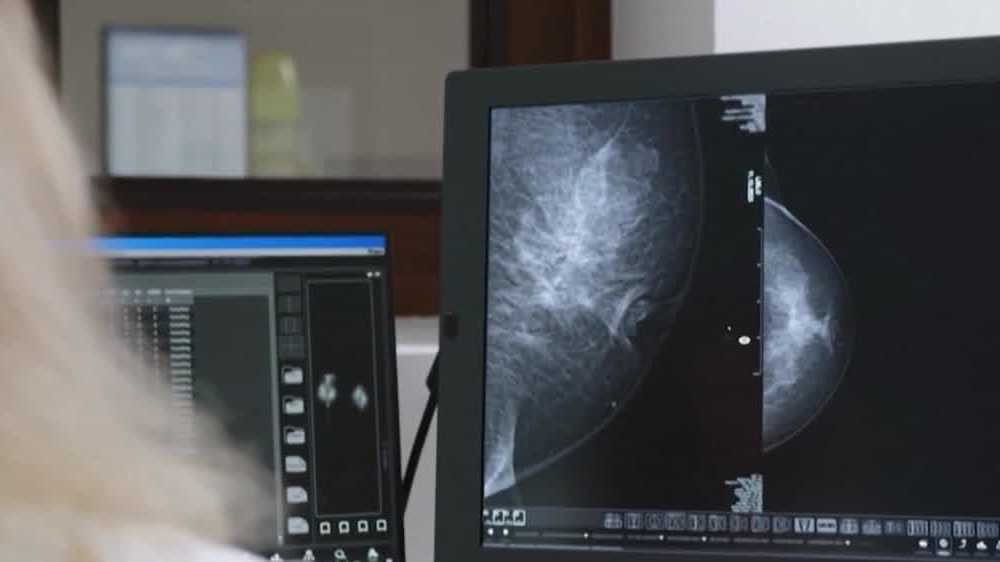 Highmark Health plan members to receive full coverage for diagnostic ...