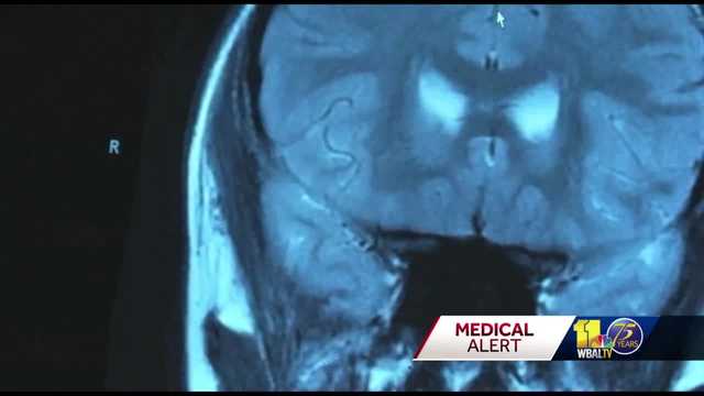 Challenges with healing are many when it comes to brain injuries - Vimarsana News