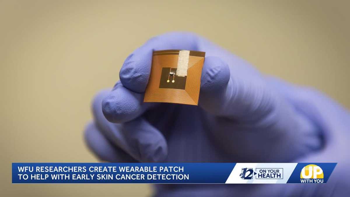 Wake Forest researchers create patch to detect skin cancer