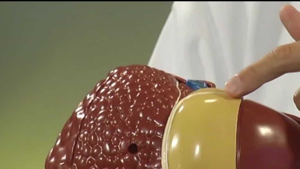 New hope for fatty liver disease patients – Gulf Coast News and Weather