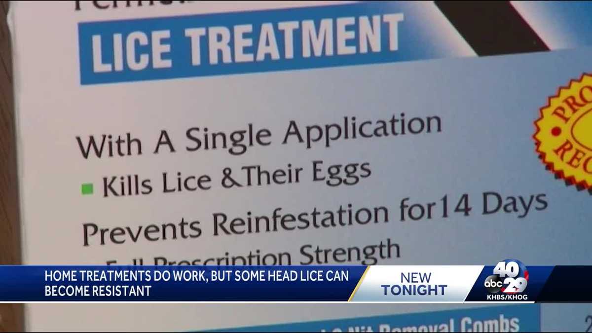 Lowell clinic exclusively treats head lice