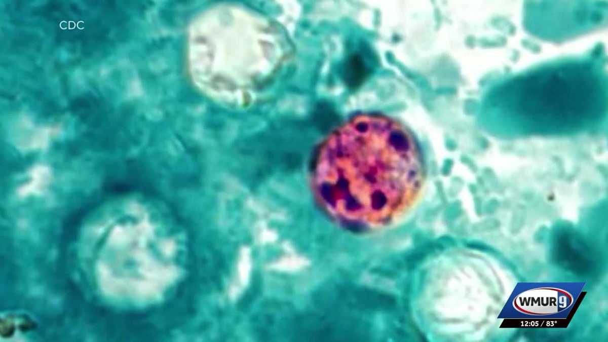 Cyclosporiasis cases continue to rise in New Hampshire
