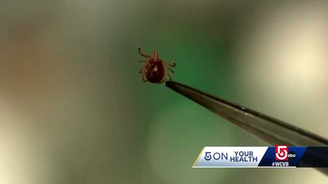 Boston doc breaks down dangers of tick-borne illnesses - Vimarsana News