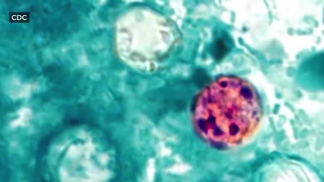 Fort Myers restaurant owner takes precaution amid Cyclospora outbreak