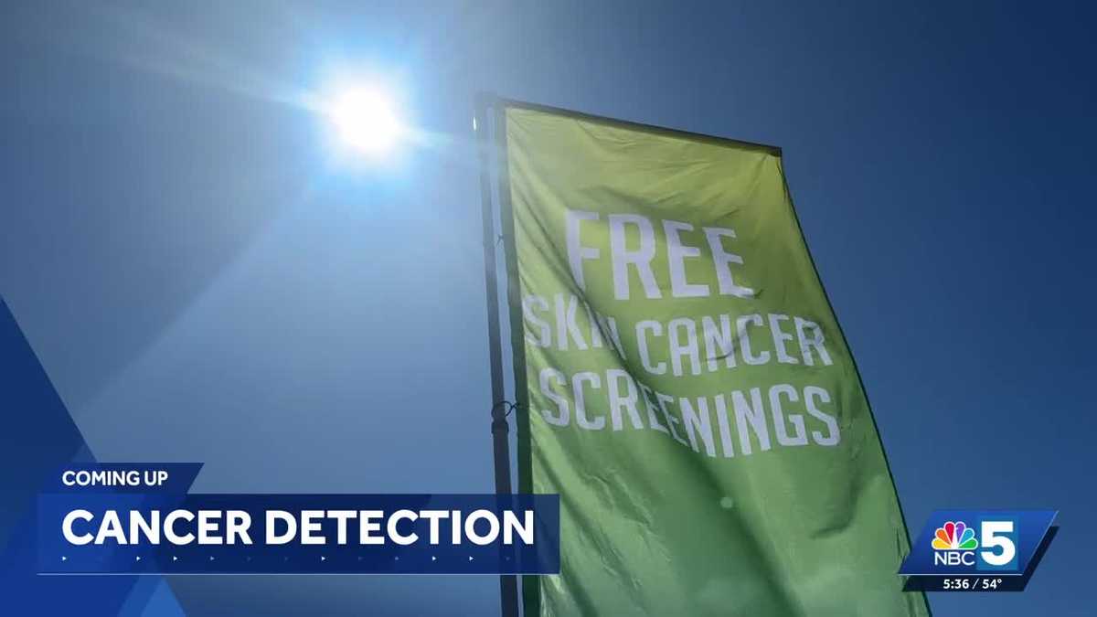 Mobile clinic brings free skin cancer screenings to Burlington
