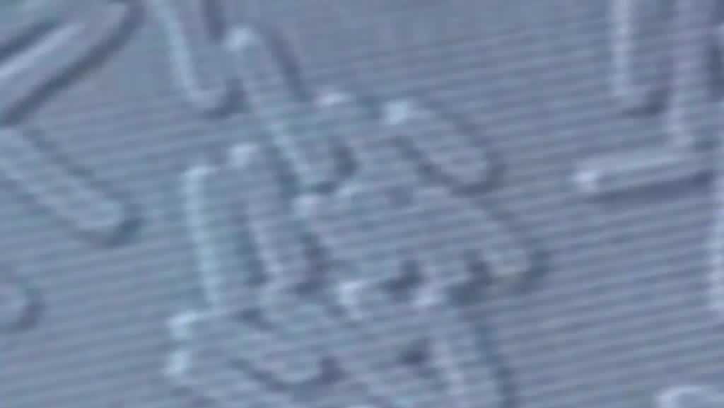 More than 100 cases of Legionnaires' disease confirmed for the year in Orange County