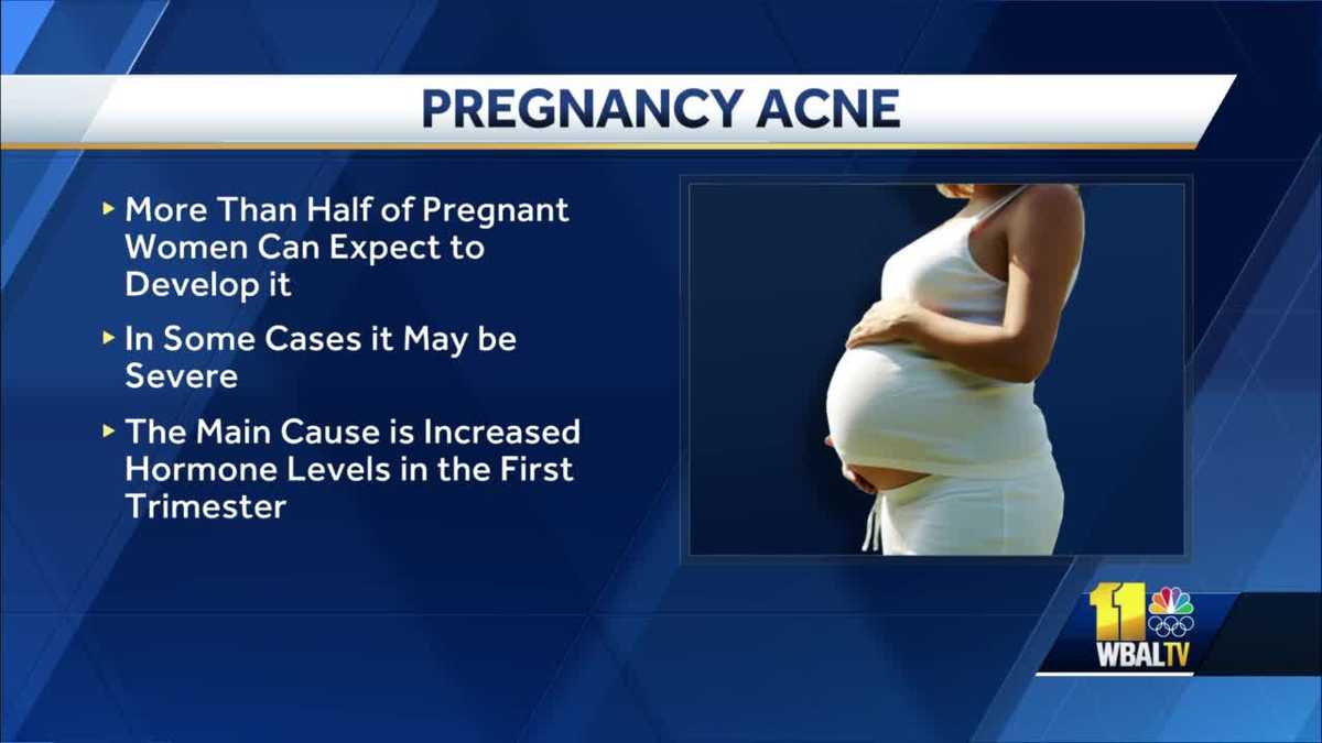How to deal with acne during pregnancy