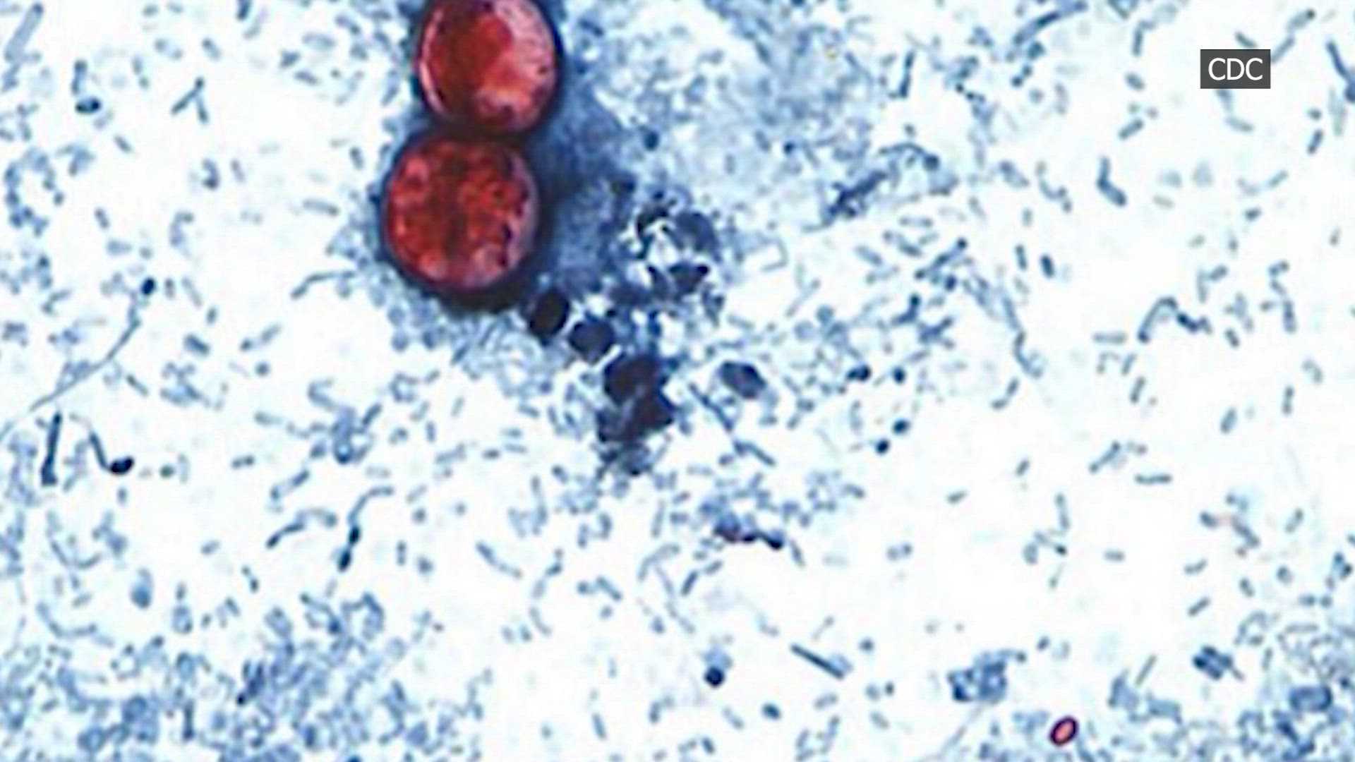 First deaths reported in cyclosporiasis outbreak