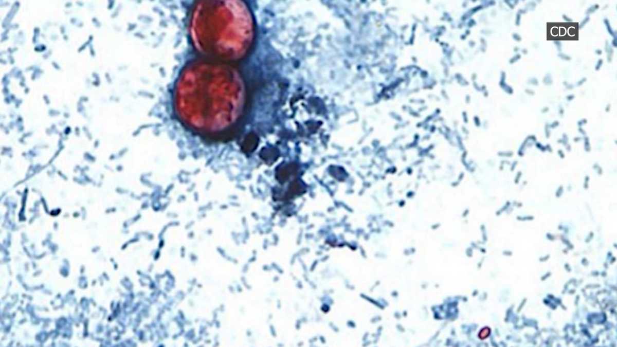 First deaths reported in cyclosporiasis outbreak