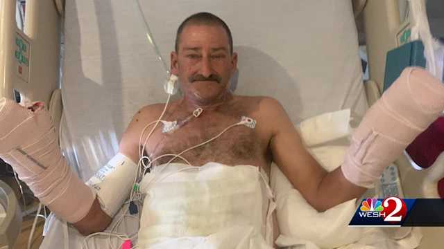 Orlando man injured in firework accident, he says - Vimarsana News