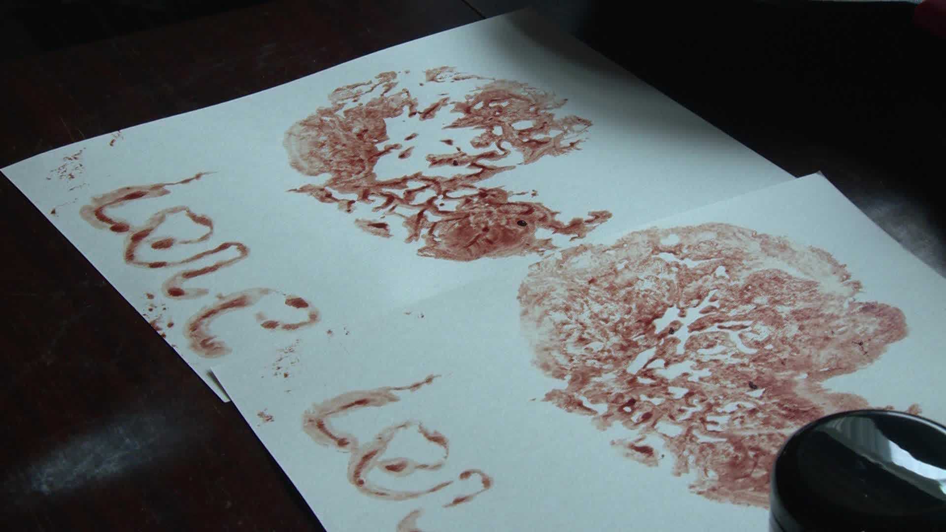 ［入手困難］ PLACENTA／CONDEMNED b7f749bb-44b9-4cee-9734-