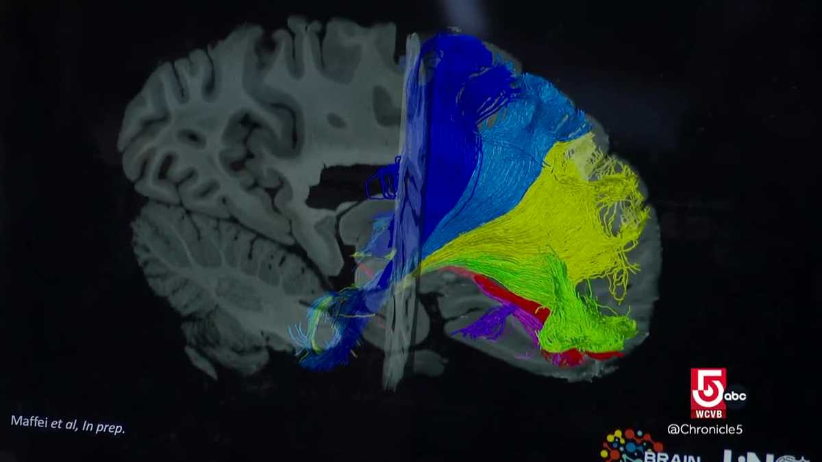 Mapping the brain at Massachusetts General Hospital