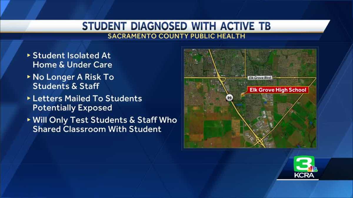 elk-grove-high-school-student-diagnosed-with-active-tuberculosis