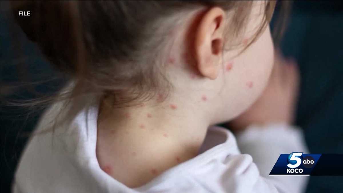 MAP Which Oklahoma counties have highest lowest measles vaccination rates KOCO Oklahoma City MAP Which Oklahoma counties have highest lowest measles vaccination rates KOCO Oklahoma City