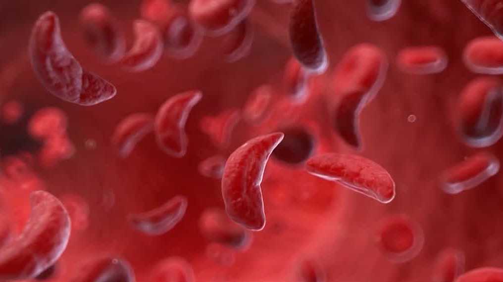 Red Cross, Dartmouth College partner for blood drive to help sickle cell patients