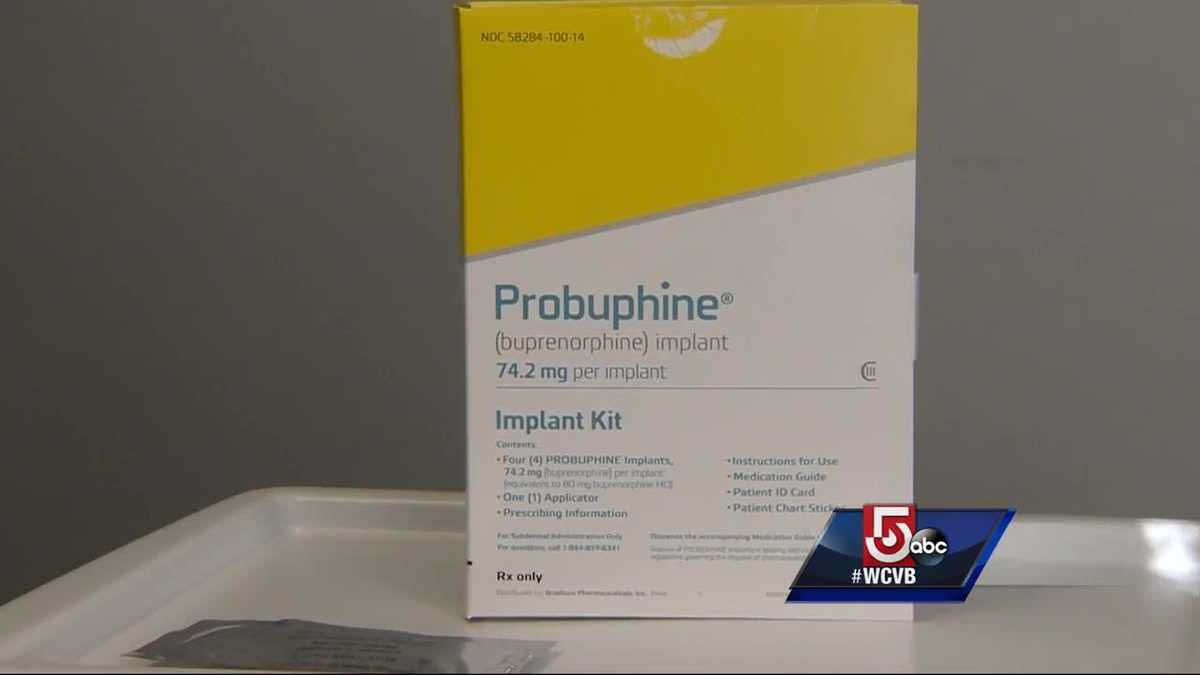 Doctors hopeful with new implantable opioid treatment