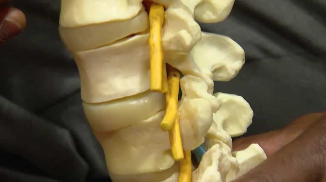 Woman's Doctor: Older women at greater risk for spinal fractures