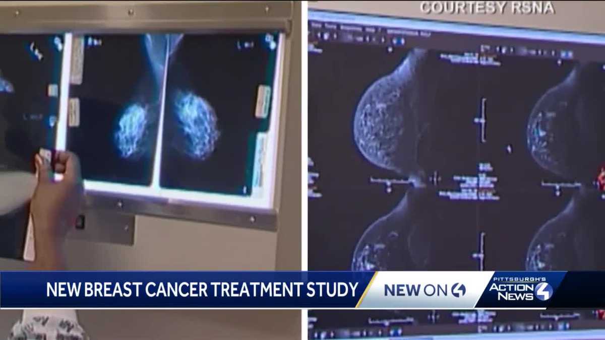 ‘Sometimes less is better:’ Study looks at treatment of breast cancer ...