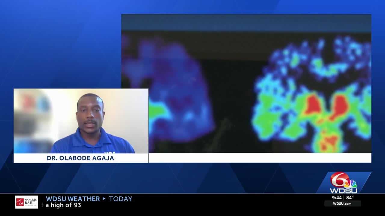 Louisiana kids at risk: Concussion warning signs
