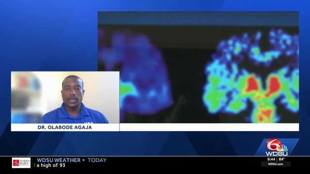 Louisiana kids at risk: Concussion warning signs