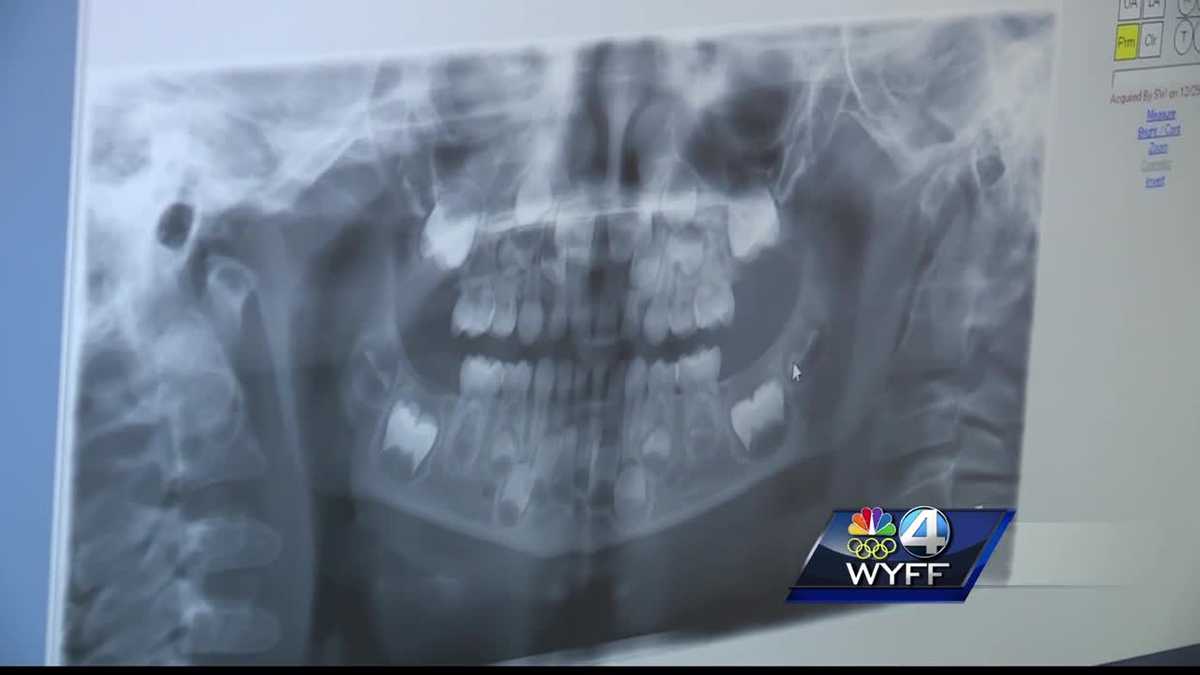 Nationwide dental chain accused of performing unnecessary dental