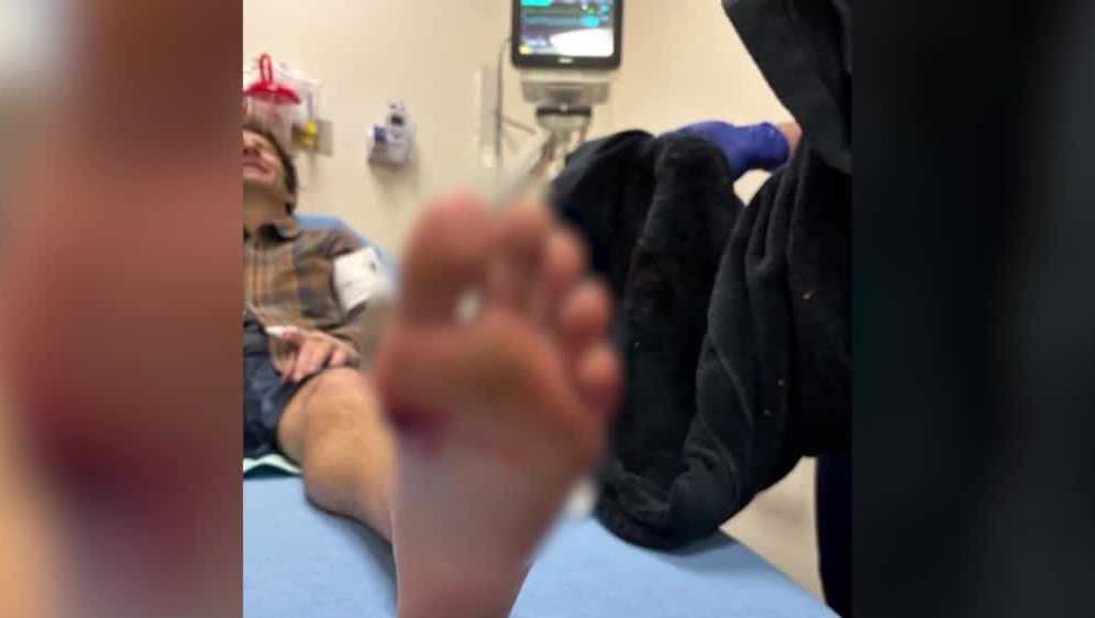 Paddleboarder bitten by shark in Flagler Beach speaks about encounter